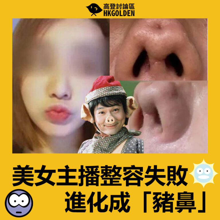 美女主播整容失敗  進化成「豬鼻」　