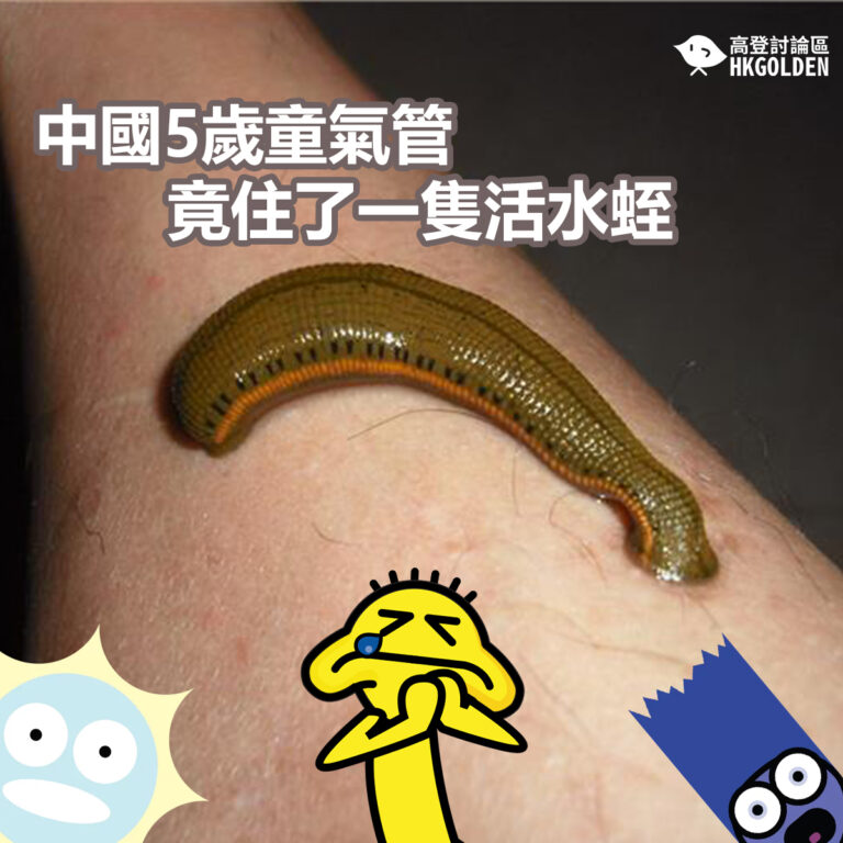中國5歲童氣管竟住了一隻活水蛭