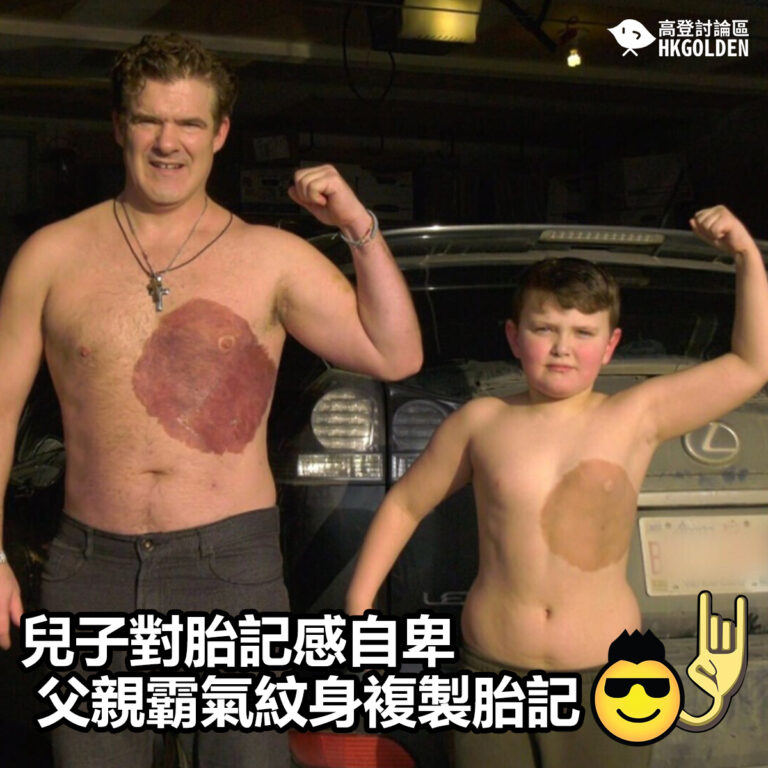 【兒子對胎記感自卑 父親霸氣紋身複製胎記】