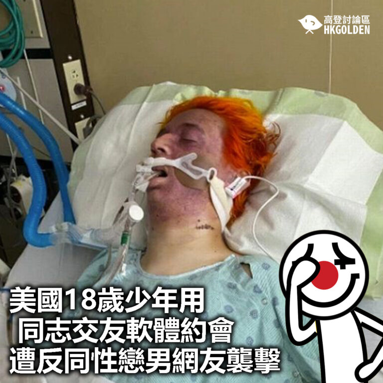 【美國18歲少年用同志交友軟體約會　遭反同性戀男網友襲擊】