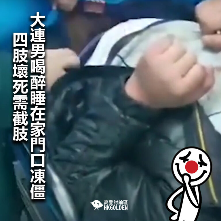 【大連男喝醉睡在家門口凍僵　四肢壞死需截肢 】