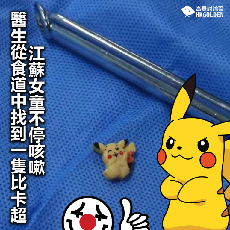 【江蘇女童不停咳嗽  醫生從食道中找到一隻比卡超】