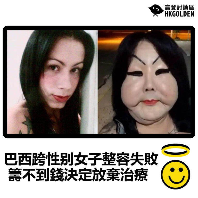 【巴西跨性别女子整容失敗   籌不到錢決定放棄治療】