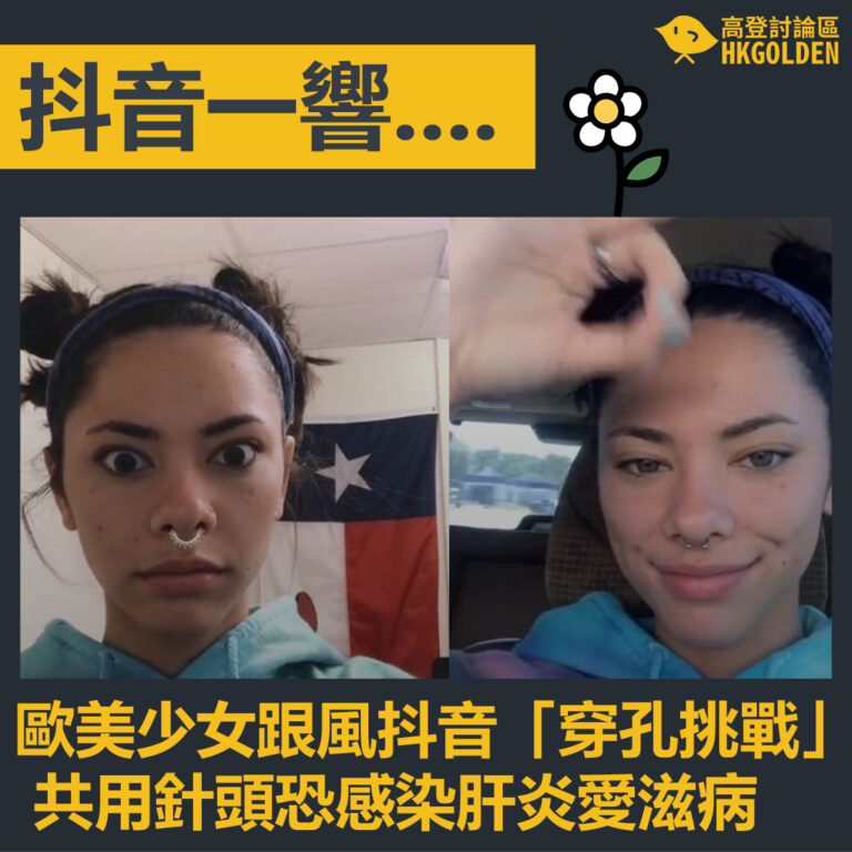 【歐美少女跟風抖音「穿孔挑戰」 共用針頭恐感染肝炎愛滋病】