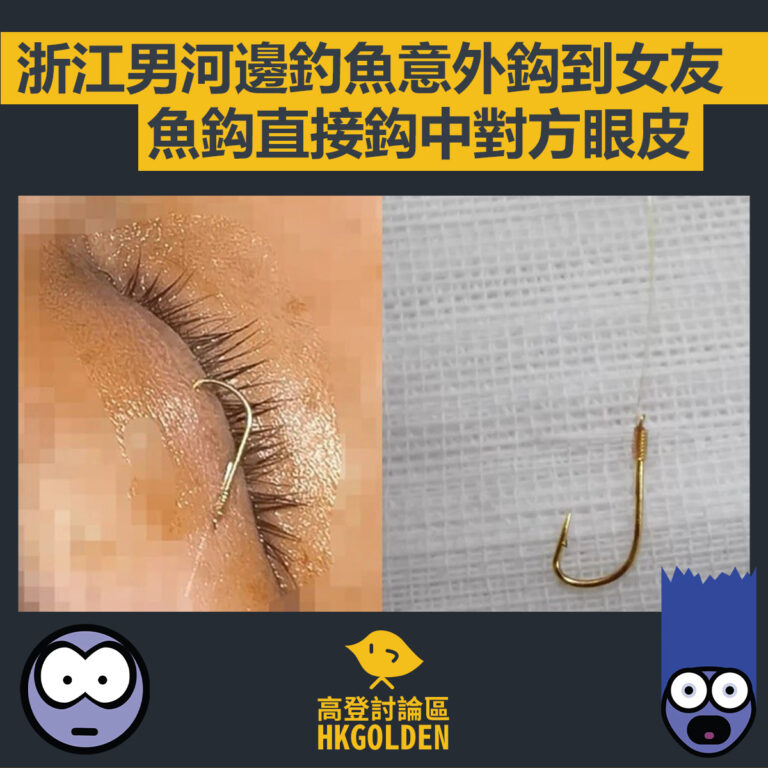 【浙江男河邊釣魚意外鈎到女友 魚鈎直接鈎中對方眼皮】