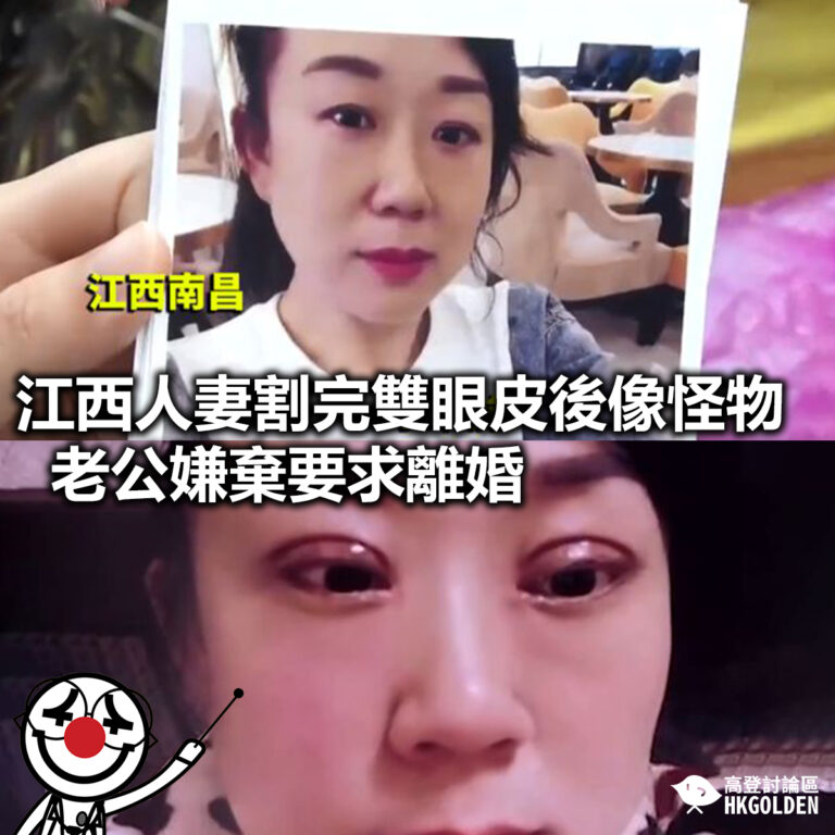 【江西人妻割完雙眼皮後像怪物  老公嫌棄要求離婚】