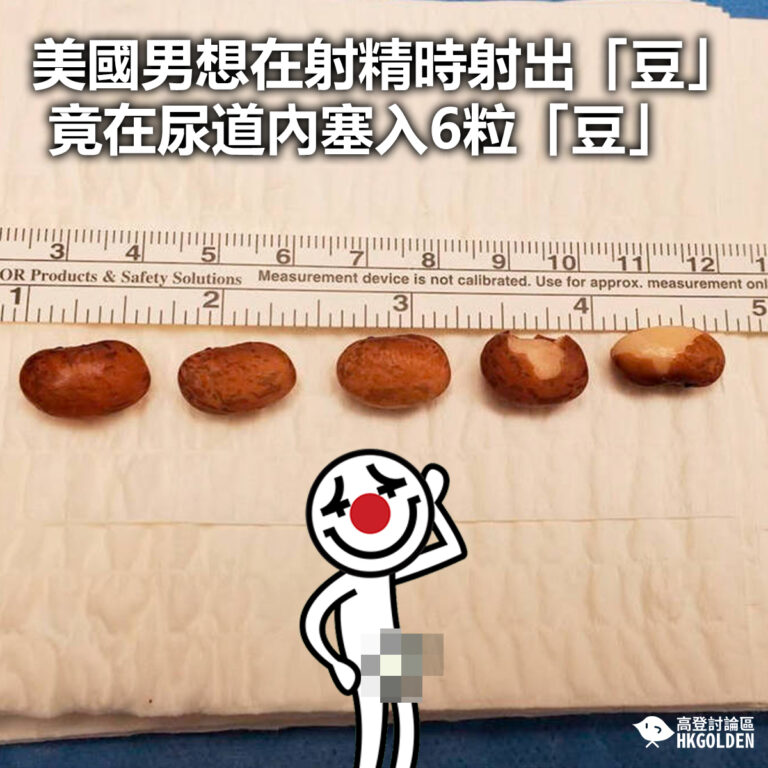 【美國男想在射精時射出「豆」 竟在尿道內塞入6粒「豆」】
