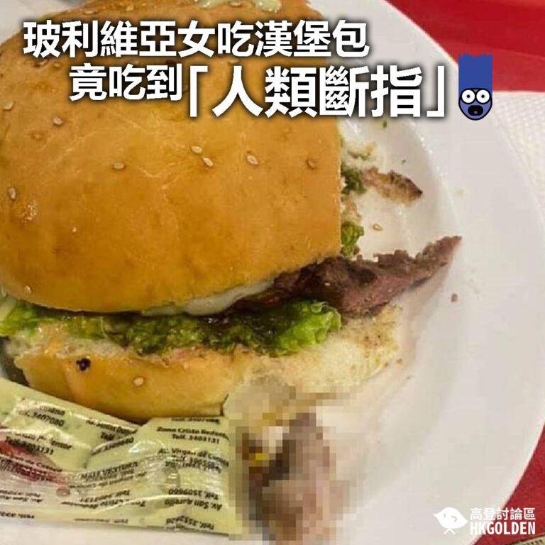 【玻利維亞女吃漢堡包 竟吃到「人類手指」】