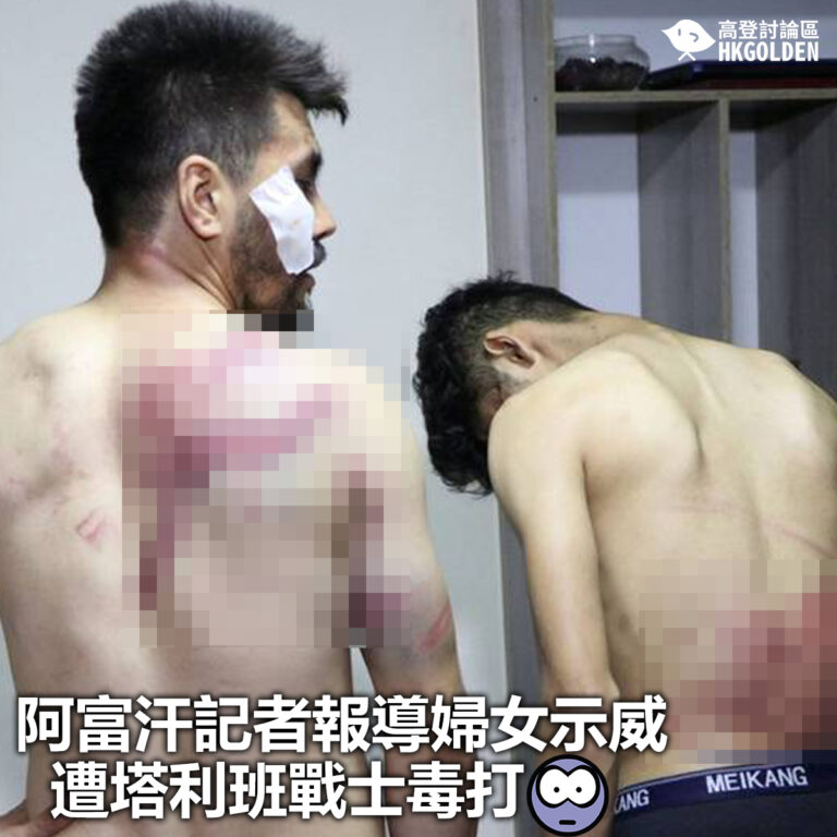 【阿富汗記者報導婦女示威 遭塔利班戰士毒打】