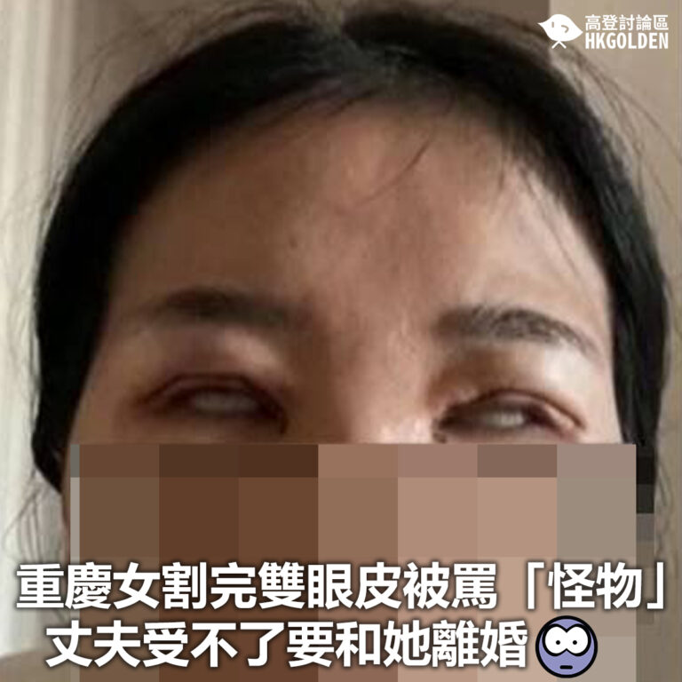 【重慶女割完雙眼皮被罵「怪物」 丈夫受不了要和她離婚】