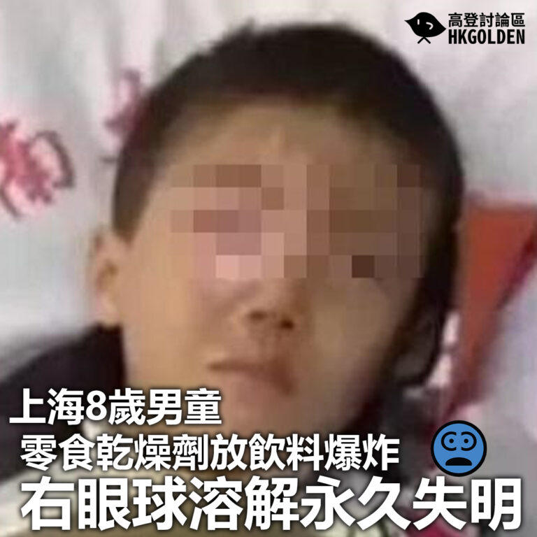 【上海8歲男童零食乾燥劑放飲料爆炸 右眼球溶解永久失明】