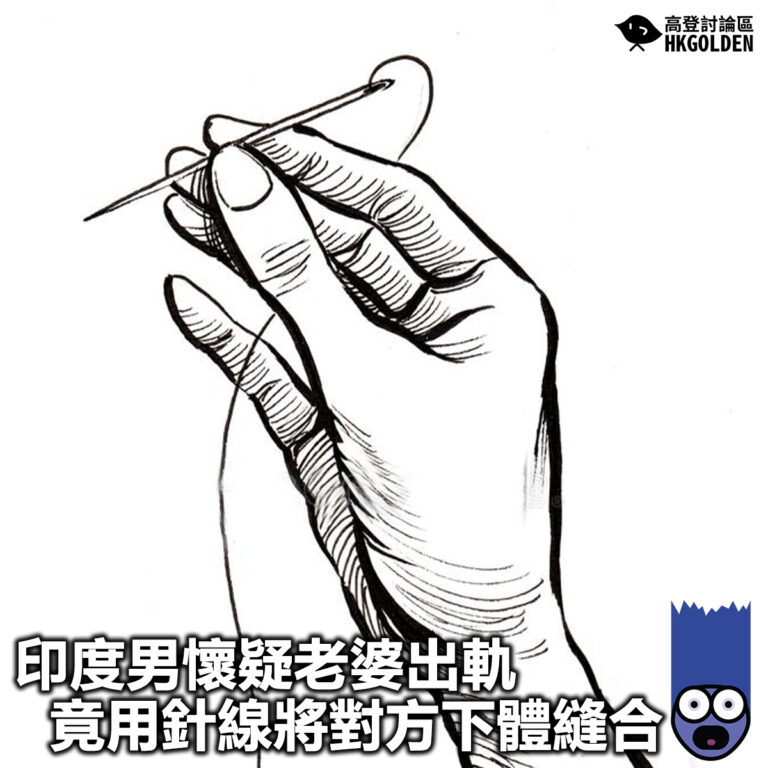 【印度男懷疑老婆出軌 竟用針線將對方下體縫合】
