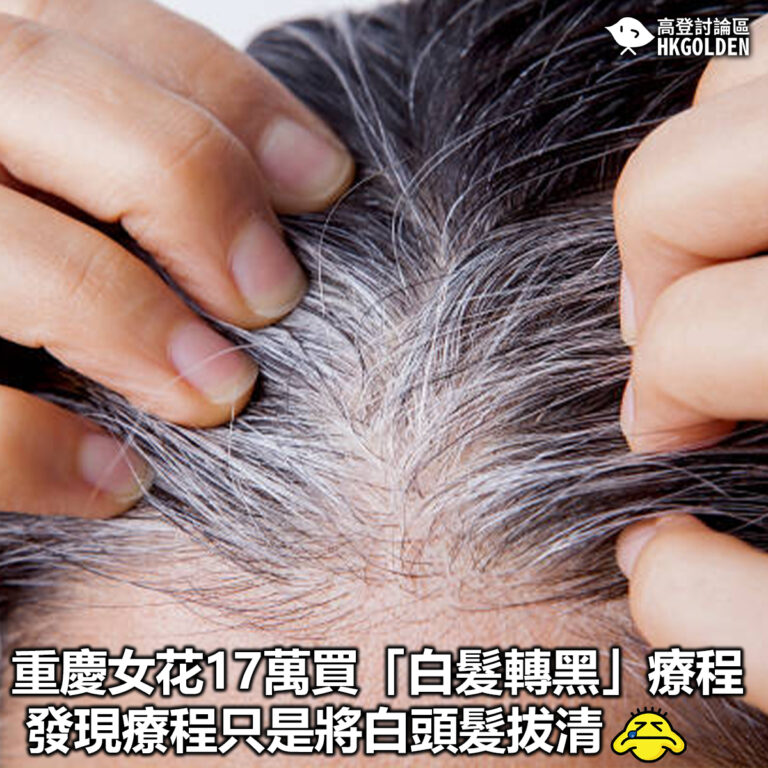 【重慶女花17萬買「白髮轉黑」療程 發現療程只是將白頭髮拔清】