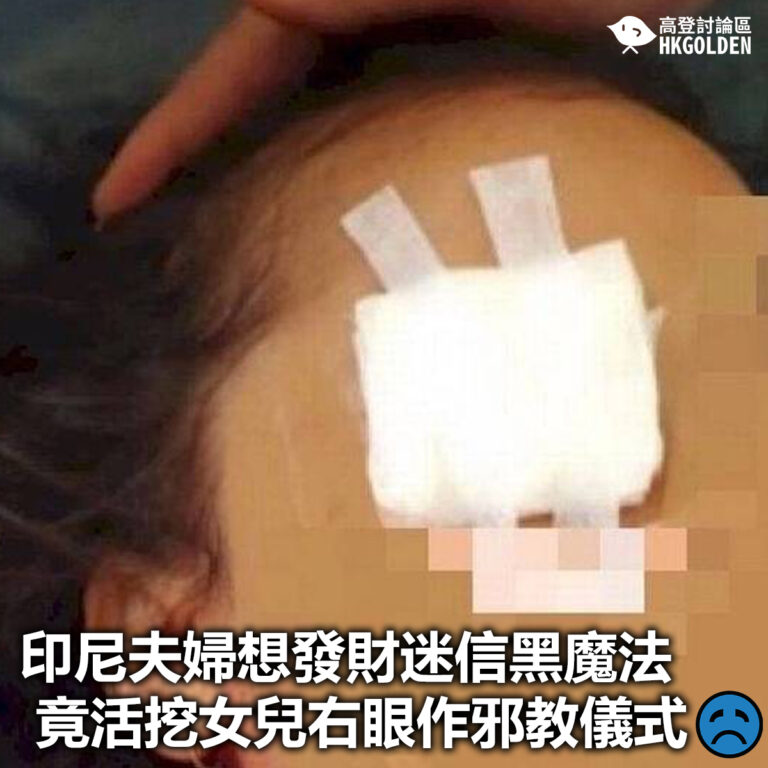 【印尼夫婦想發財迷信黑魔法 竟活挖女兒右眼作邪教儀式】
