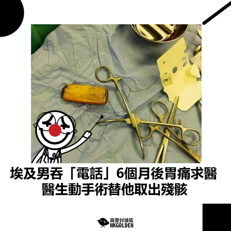 【埃及男吞「電話」6個月後胃痛求醫 醫生動手術替他取出殘骸】