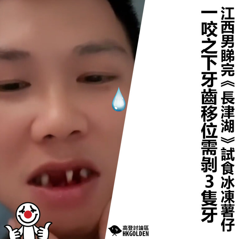 【江西男睇完《長津湖》試食冰凍薯仔 一咬牙齒移位需剝3隻牙】