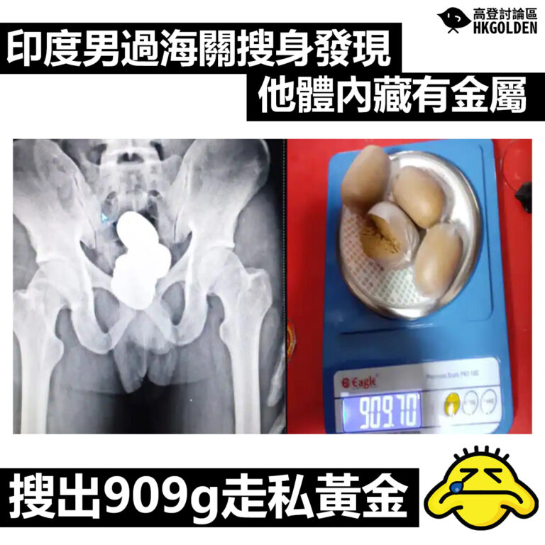 【印度男過海關搜身發現他體內藏有金屬  搜出909g走私黃金藏直腸】