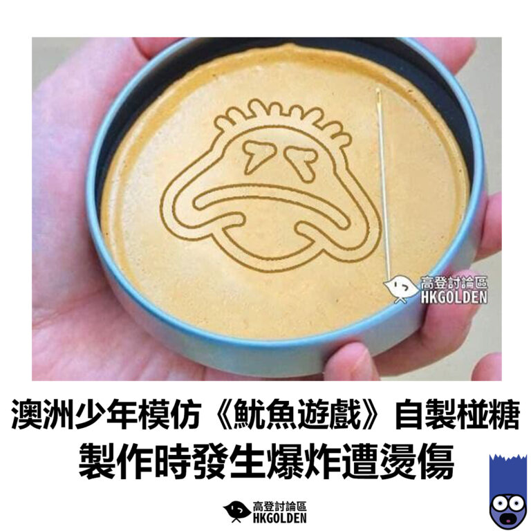 【澳洲少年模仿《魷魚遊戲》自製椪糖 製作時發生爆炸遭燙傷】