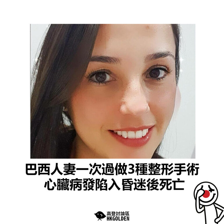 【巴西人妻一次過做3種整形手術  心臟病發陷入昏迷後死亡】