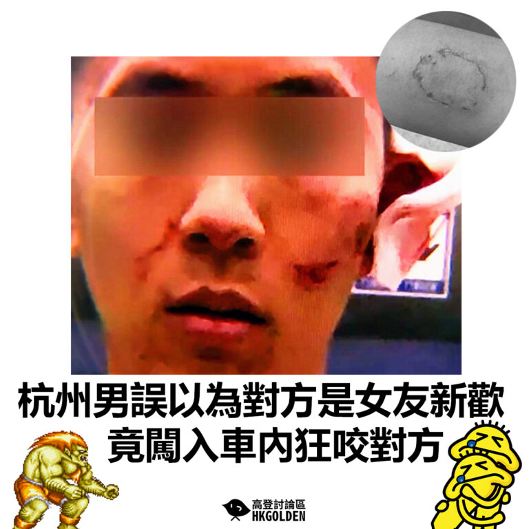 【杭州男誤以為對方是女友新歡 竟闖入車內狂咬對方】