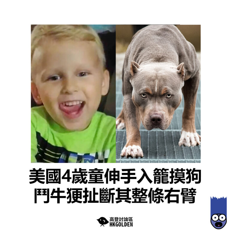 【美國4歲童伸手入籠摸狗 鬥牛㹴扯斷其整條右臂】
