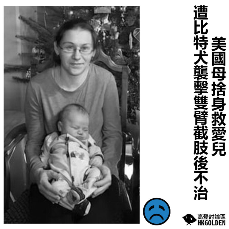 【美國母捨身救愛兒 遭比特犬襲擊雙臂截肢後不治】