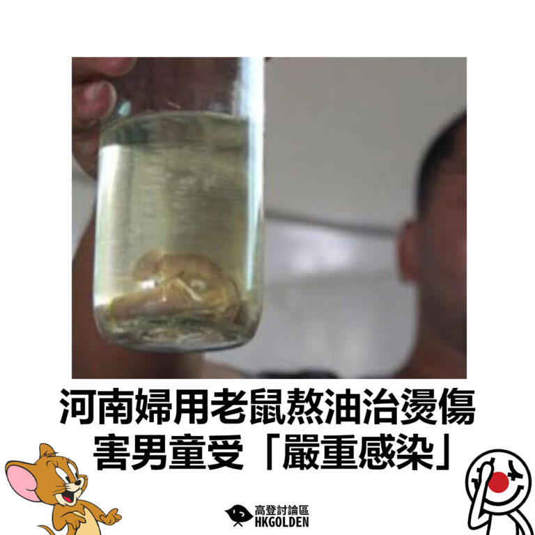 【河南婦用老鼠熬油治燙傷　害男童受「嚴重感染」】