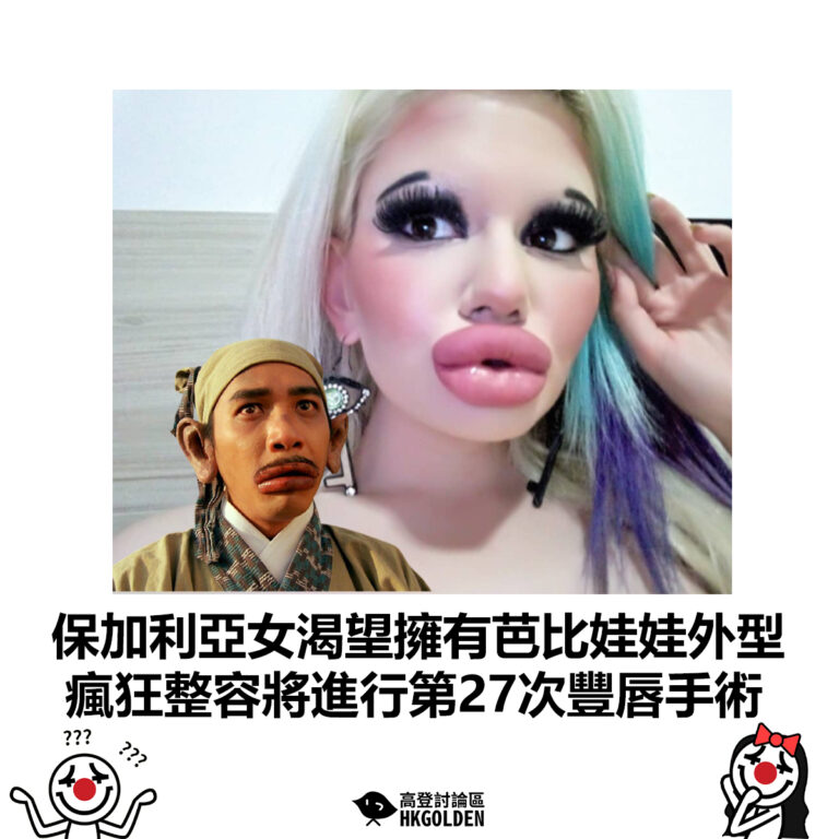 【保加利亞女渴望擁有芭比娃娃外型 瘋狂整容將進行第27次豐唇手術】