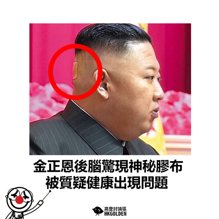 【金正恩後腦驚現神秘膠布 被質疑健康出現問題】