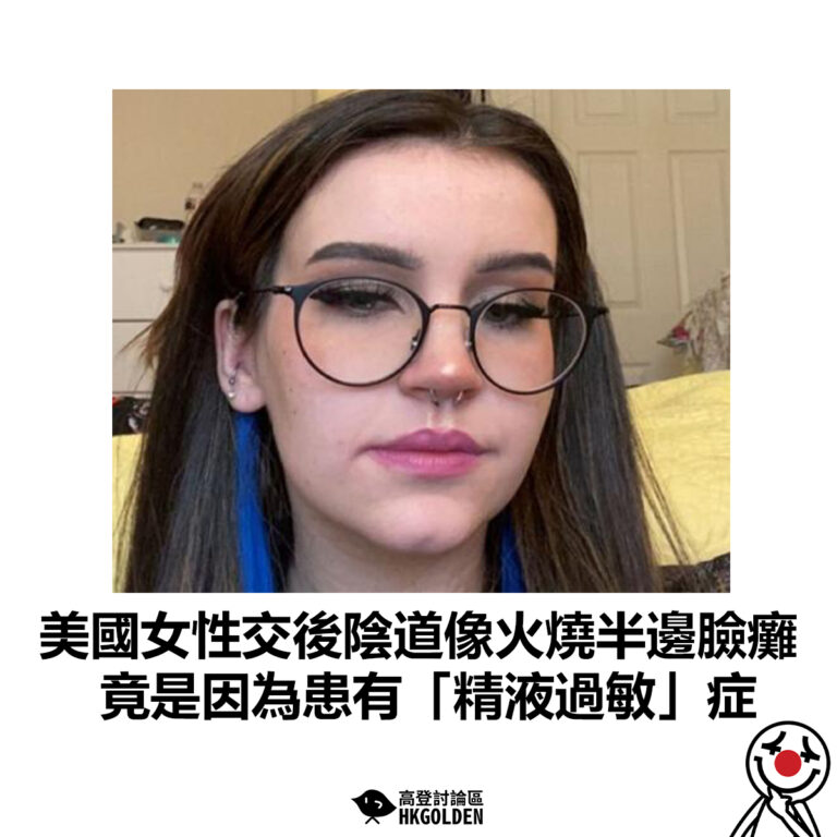 【美國女性交後陰道像火燒半邊臉癱 竟是因為患有「精液過敏」症】