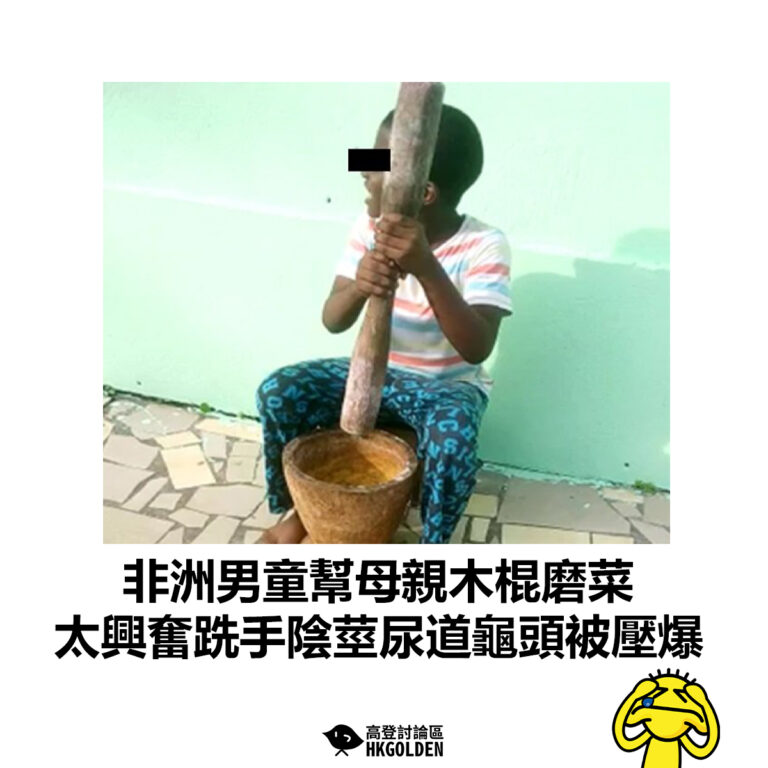 【非洲男童幫母親木棍磨菜 太興奮跣手陰莖尿道龜頭被壓爆 】