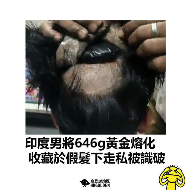 【印度男將646g黃金熔化 收藏於假髮下走私被識破】