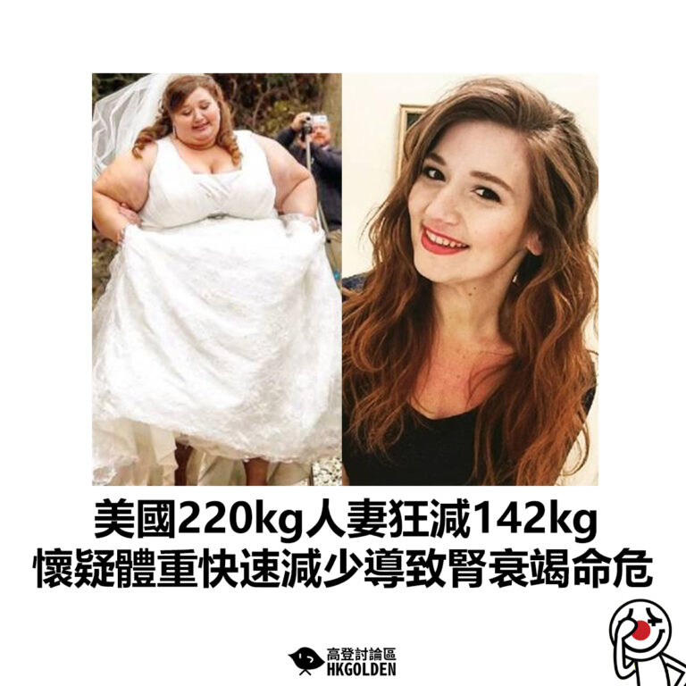 【美國220kg人妻狂減142kg 懷疑體重快速減少導致腎衰竭命危】