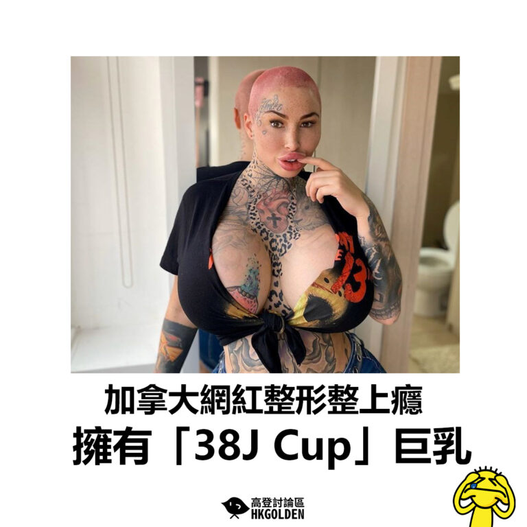 【加拿大網紅整形整上癮 擁有「38J Cup」巨乳】