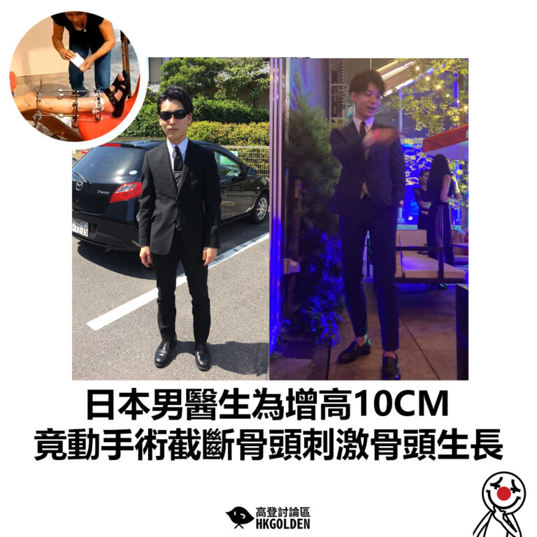 【日本男醫生為增高10CM 竟動手術截斷骨頭刺激骨頭生長】