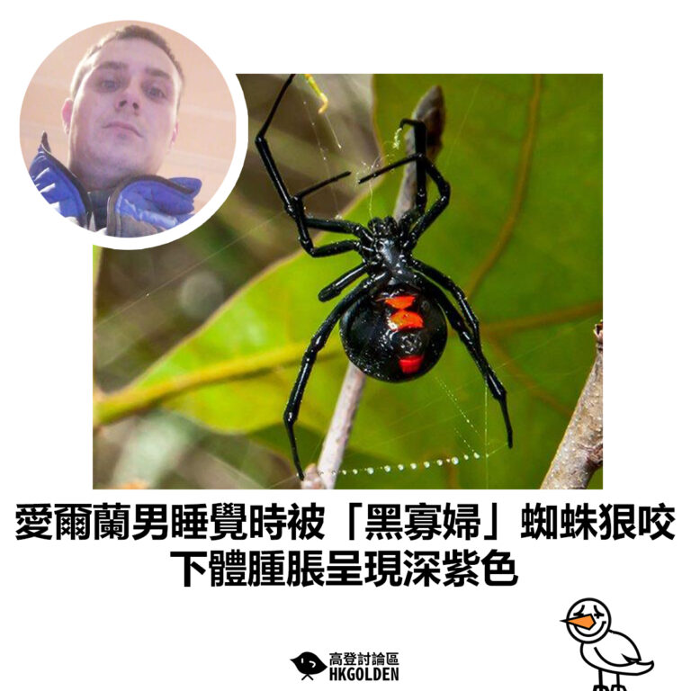 【愛爾蘭男睡覺時被「黑寡婦」蜘蛛狠咬　下體腫脹呈現深紫色】