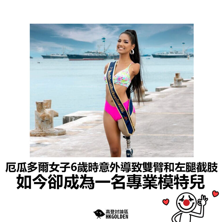 【厄瓜多爾女子6歲時意外導致雙臂和左腿截肢 如今卻成為一名專業模特兒】