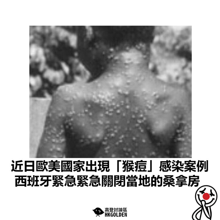 【近日歐美國家出現「猴痘」感染案例 西班牙緊急緊急關閉當地的桑拿房】
