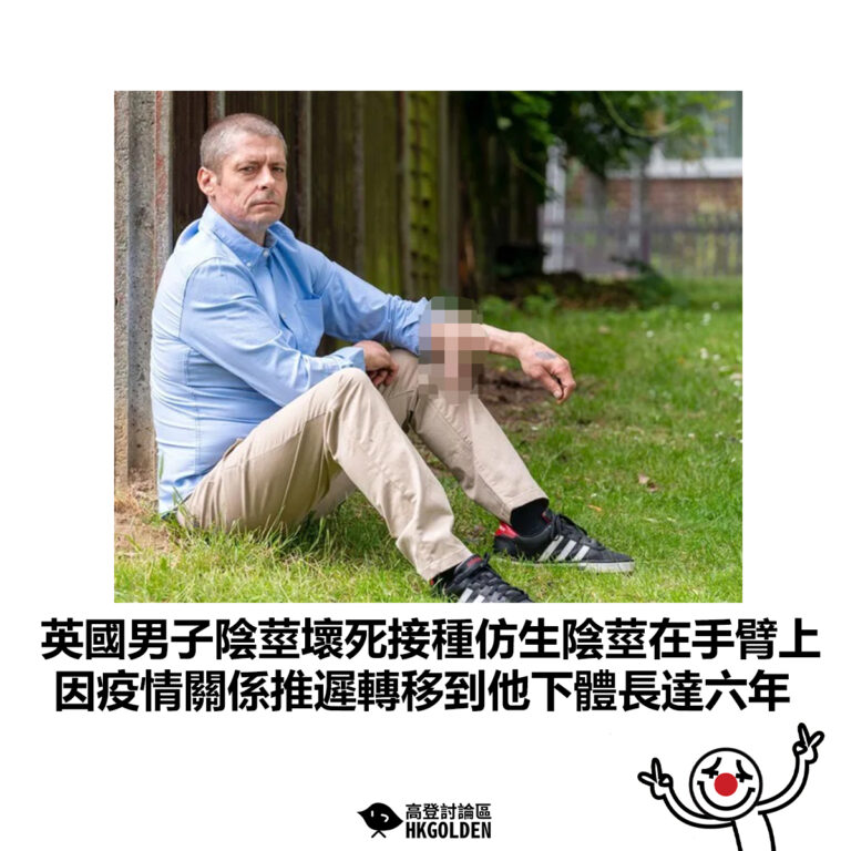 【英國男子陰莖壞死接種仿生陰莖在手臂上 因疫情關係推遲轉移到他下體長達六年】