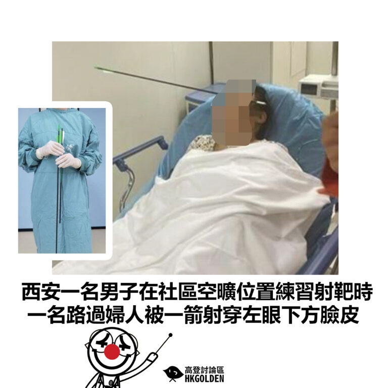 【西安一名男子在社區空曠位置練習射靶時 一名路過婦人被一箭射穿左眼下方臉皮】