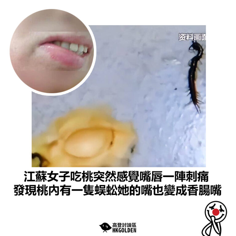 【江蘇女子吃桃突然感覺嘴唇一陣刺痛 發現桃內有一隻蜈蚣她的嘴也變成香腸嘴】