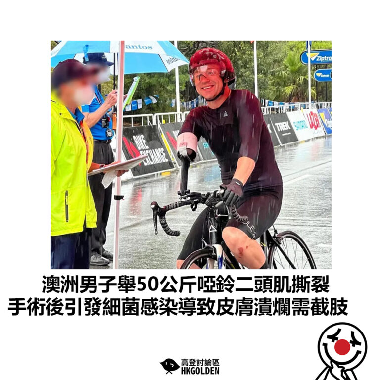 【澳洲男子舉50公斤啞鈴二頭肌撕裂 手術後引發細菌感染導致皮膚潰爛需截肢 】