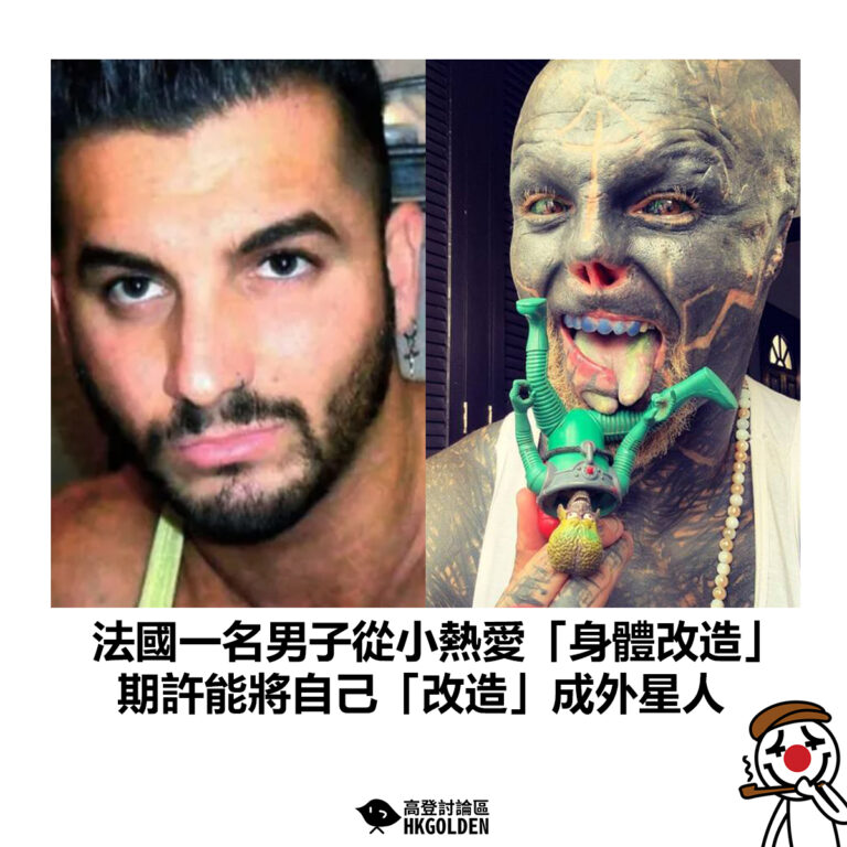 【法國一名男子從小熱愛「身體改造」 期許能將自己「改造」成外星人】
