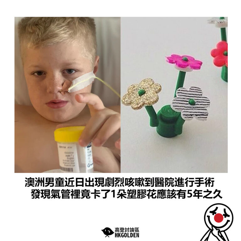 【澳洲男童近日出現劇烈咳嗽到醫院進行手術 發現氣管裡竟卡了1朵塑膠花應該有5年之久】