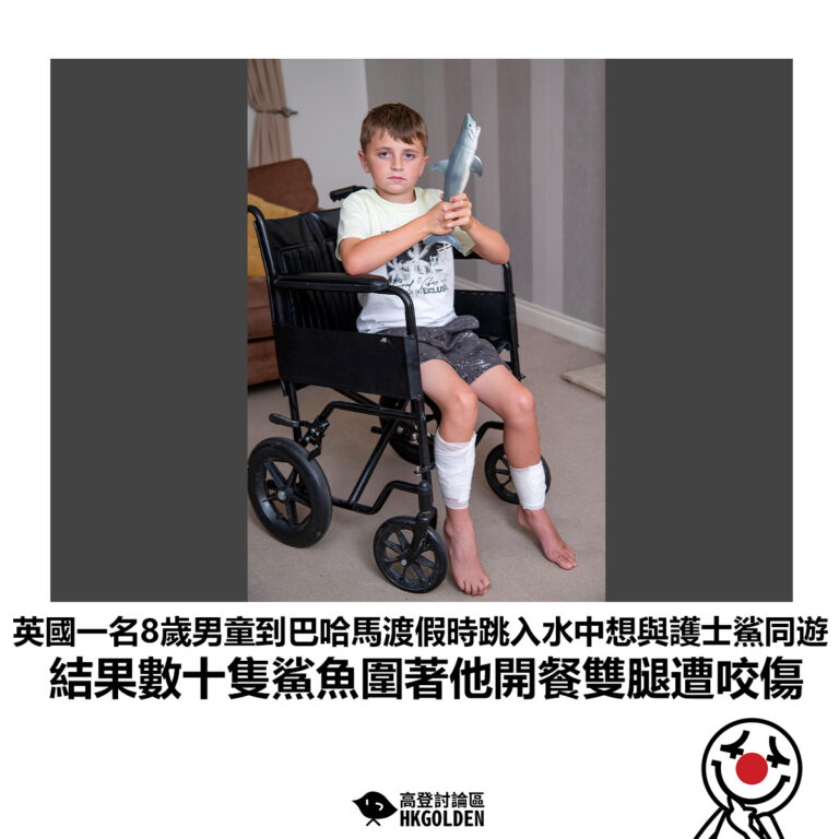 【英國一名8歲男童到巴哈馬渡假時跳入水中想與護士鯊同遊 結果數十隻鯊魚圍著他開餐雙腿遭咬傷】