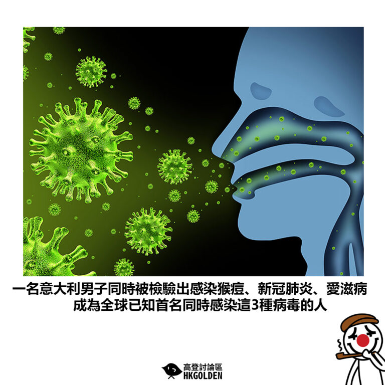 【一名意大利男子同時被檢驗出感染猴痘、新冠肺炎、愛滋病 成為全球已知首名同時感染這3種病毒的人】