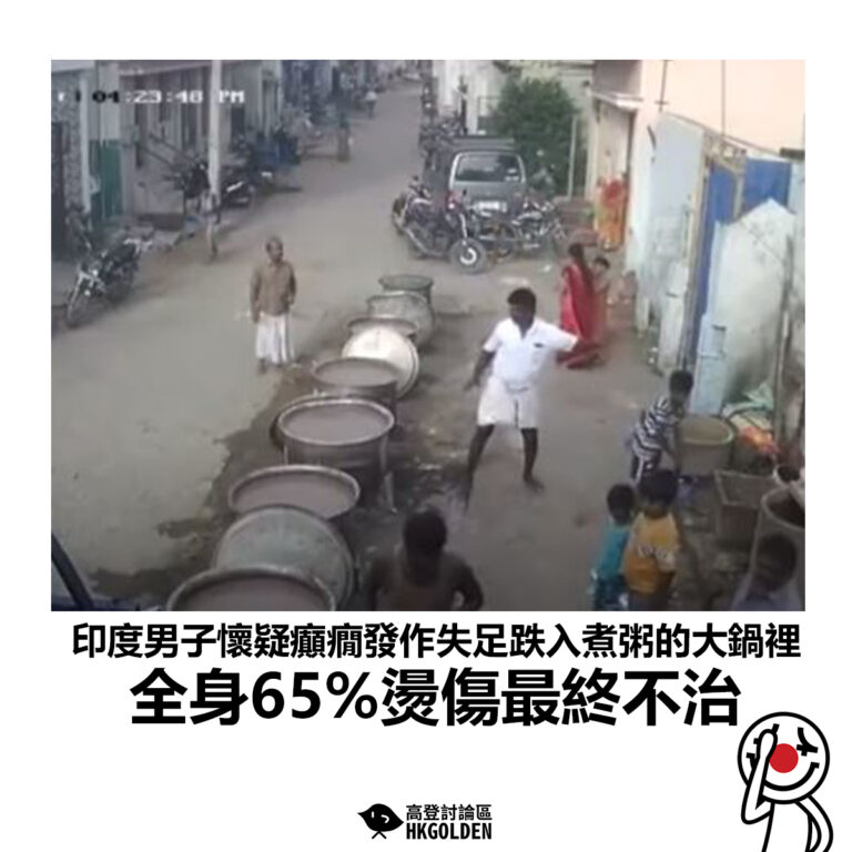 【印度男子懷疑癲癇發作失足跌入煮粥的大鍋裡 全身65%燙傷最終不治】