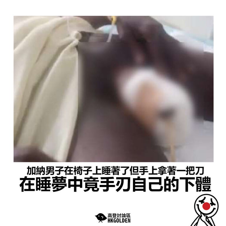 【加納男子在椅子上睡著了但手上拿著一把刀 在睡夢中手刃自己的下體 】