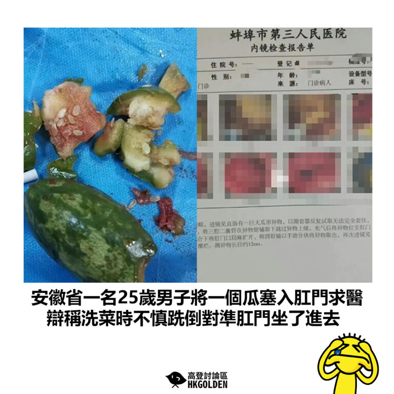 【安徽省一名25歲男子將一個瓜塞入肛門求醫 辯稱洗菜時不慎跣倒對準肛門坐了進去】