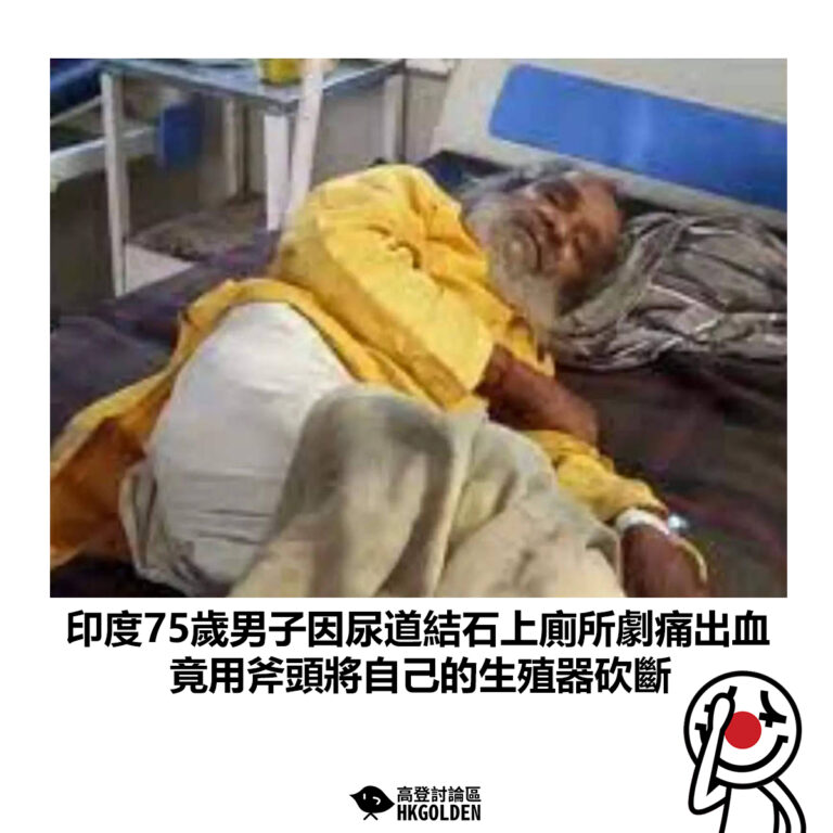 【印度75歲男子因尿道結石上廁所劇痛出血 竟用斧頭將自己的生殖器砍斷】